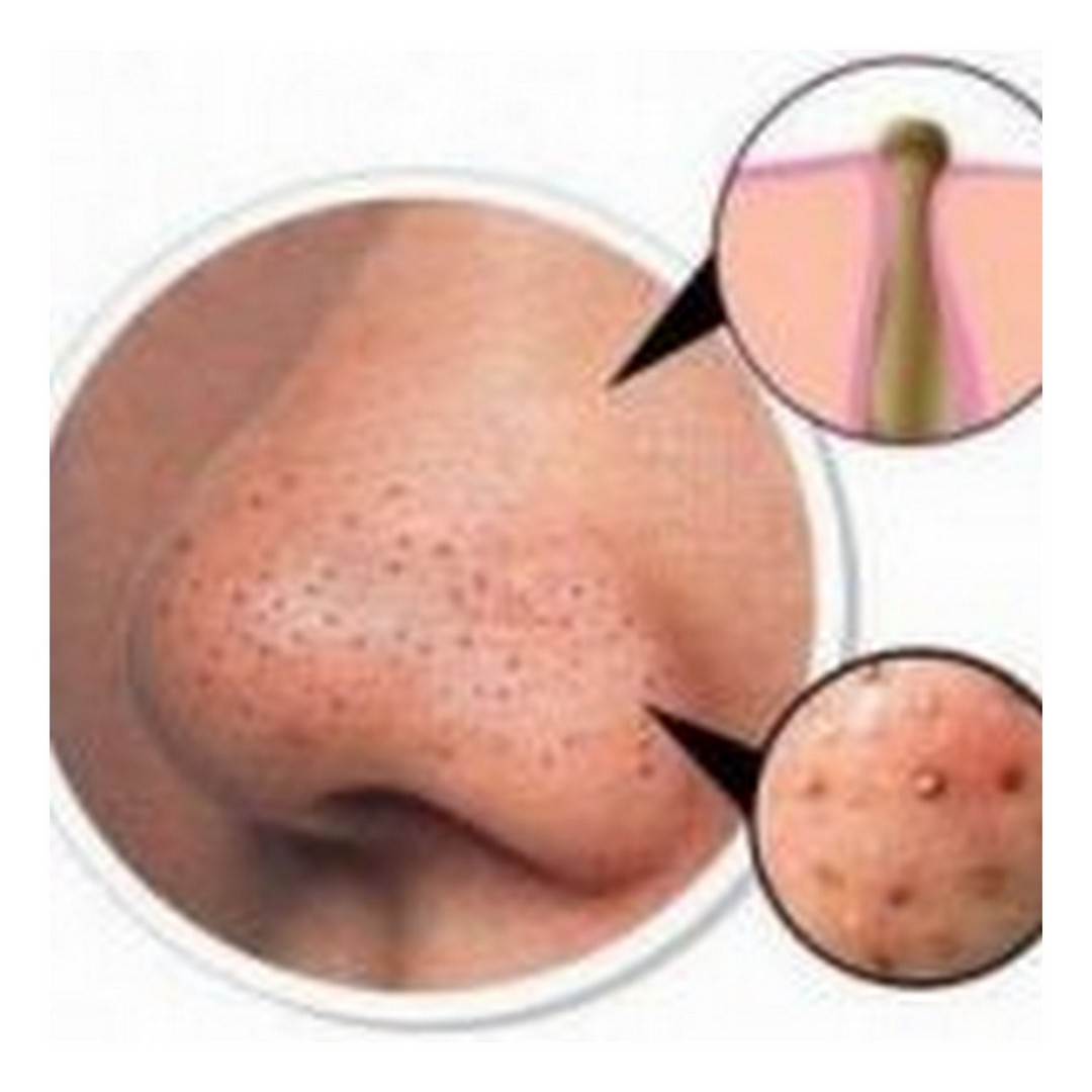 Čistiaca náplasť na nos Bambusové uhlie - Master Herb / tianDe