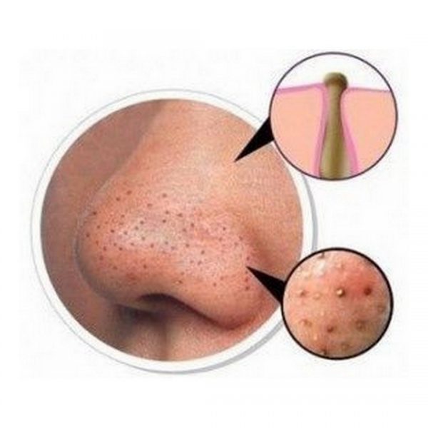 Čistiaca náplasť na nos Bambusové uhlie - Master Herb / tianDe